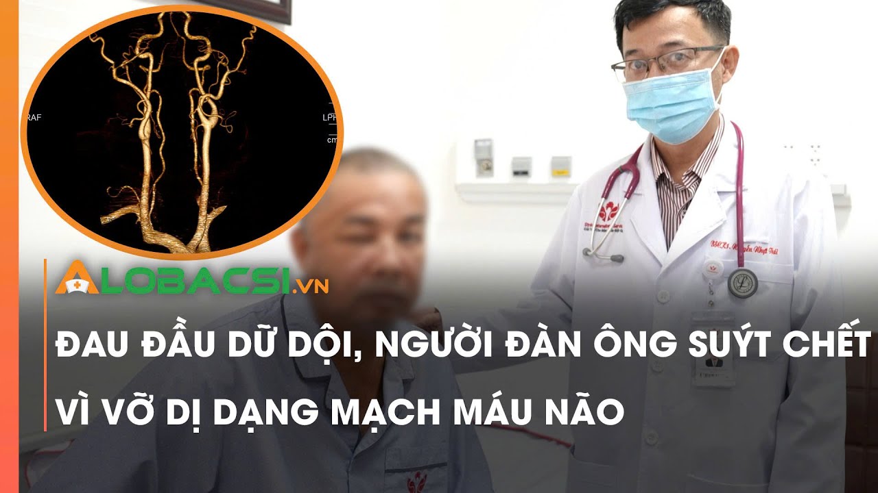 Đau đầu dữ dội, người đàn ông suýt ch.ết vì vỡ dị dạng mạch máu não