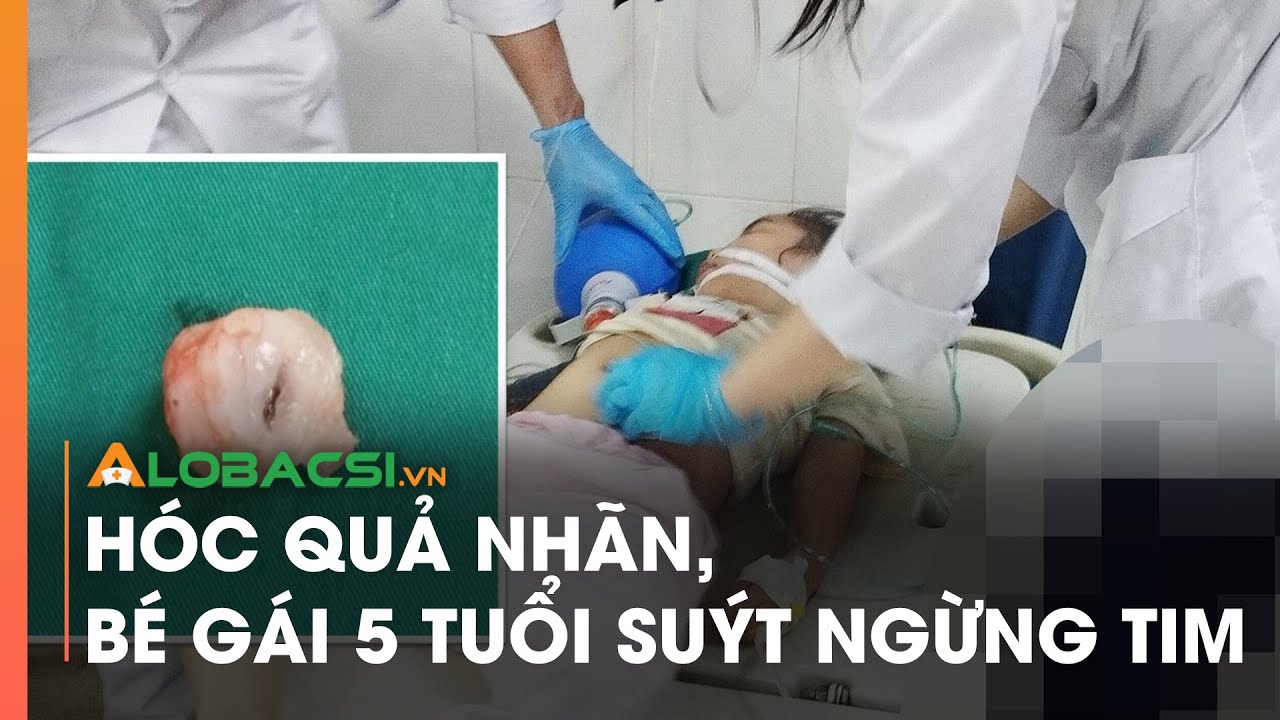 Hóc quả nhãn, bé gái 5 tuổi suýt ngừng tim