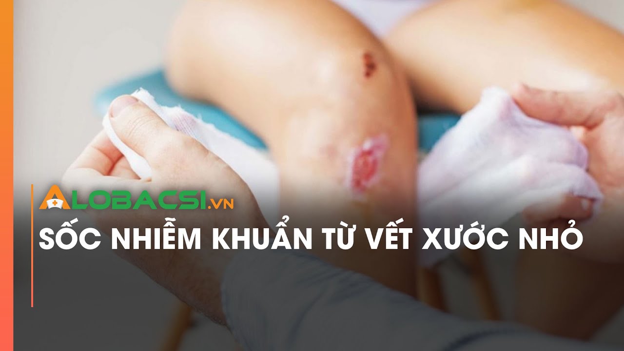 Sốc nhiễm khuẩn từ vết xước nhỏ