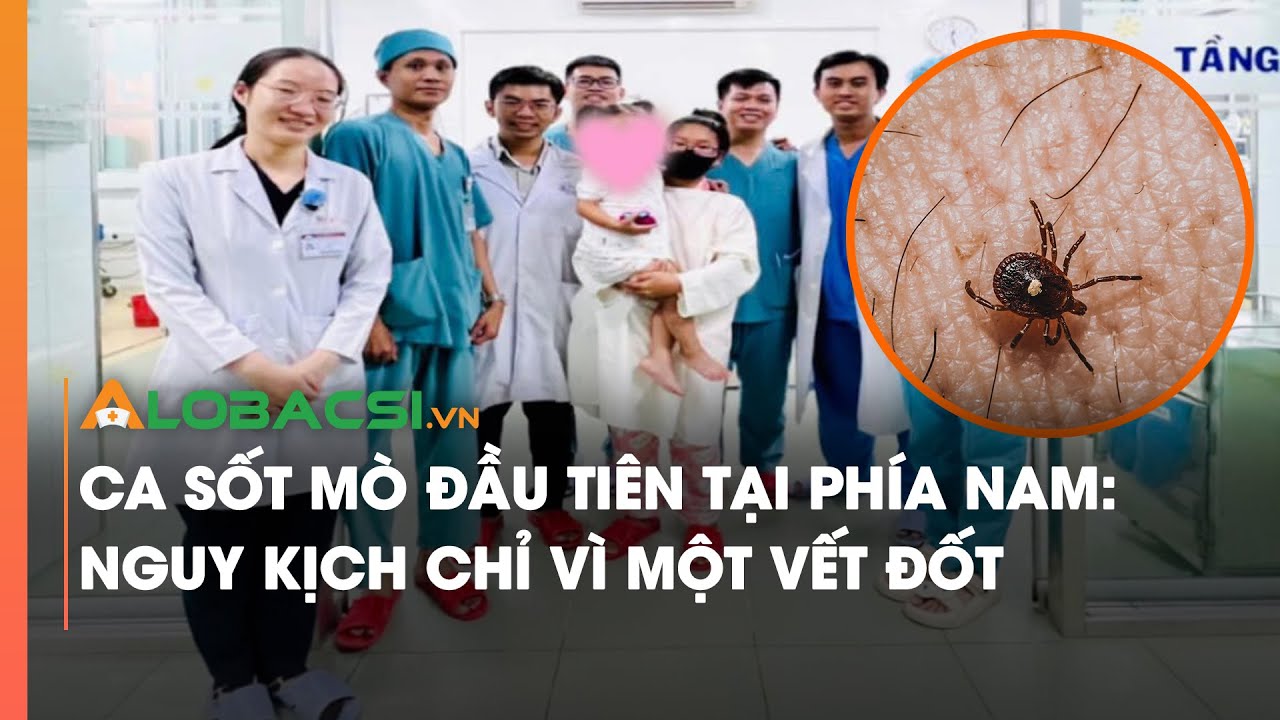 Ca sốt mò đầu tiên tại phía Nam Nguy kịch chỉ vì một vết đốt