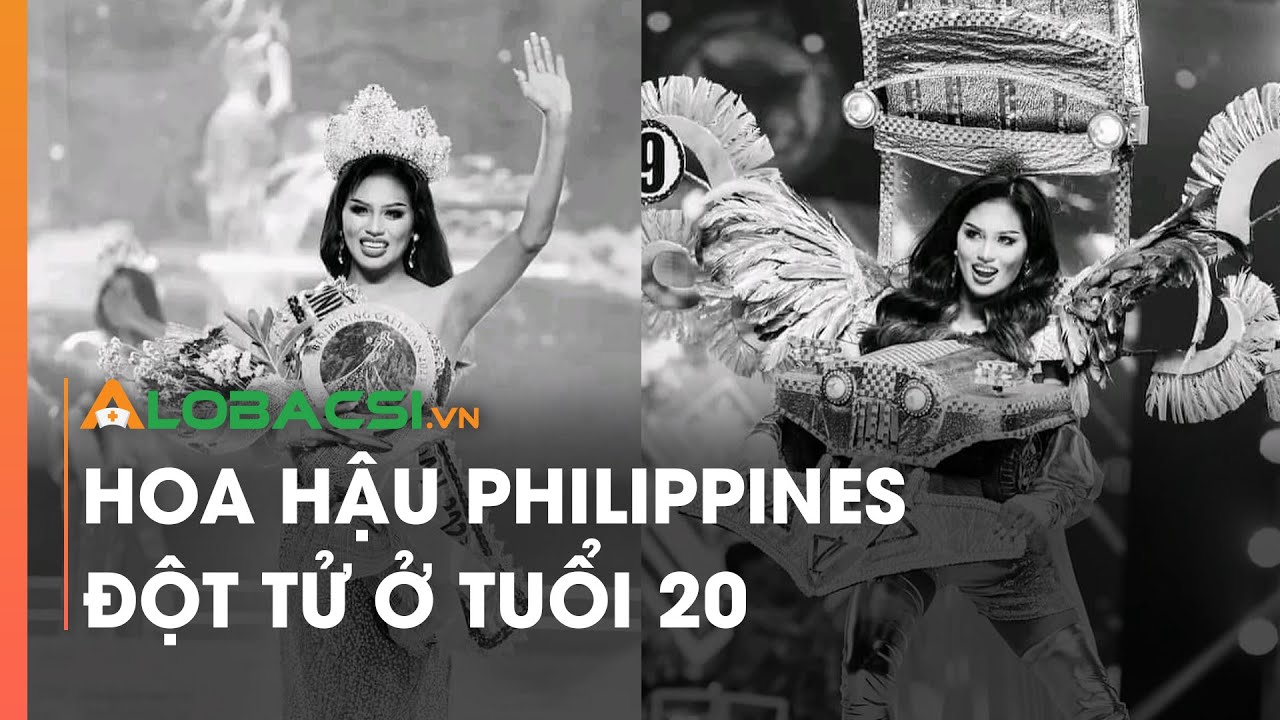 Hoa hậu Philippines đột tử ở tuổi 20