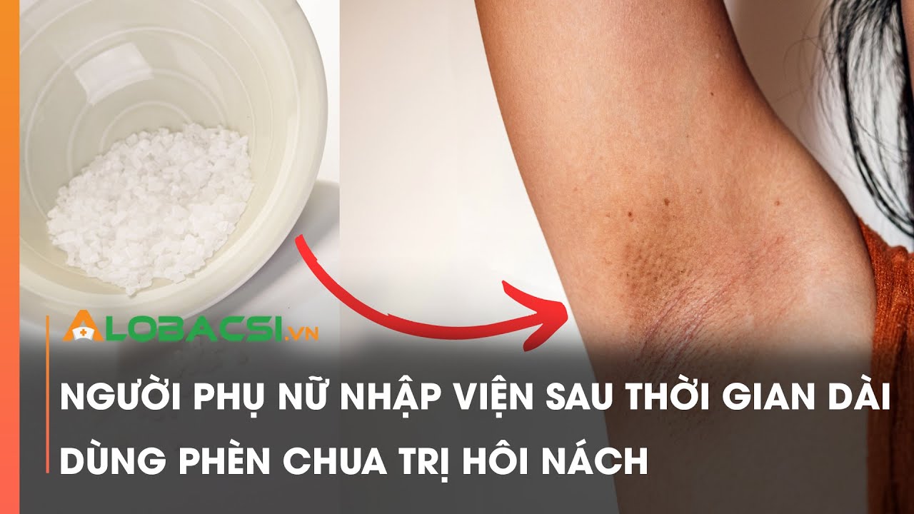 Người phụ nữ nhập viện sau thời gian dài dùng phèn chua trị hôi nách