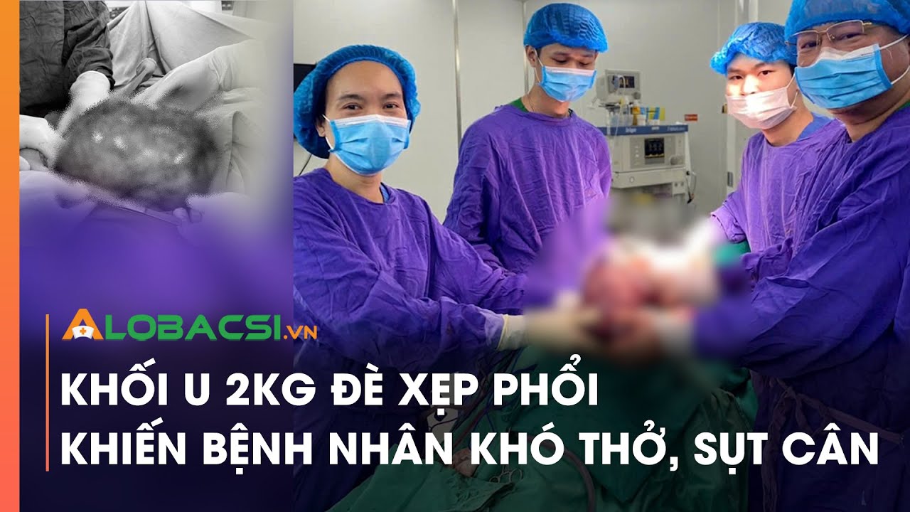 Khối u 2kg đè xẹp phổi khiến bệnh nhân khó thở, sụt cân