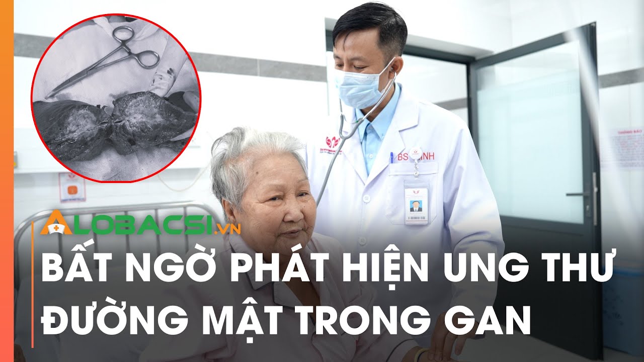 Đi khám tim, bất ngờ phát hiện ung thư đường mật trong gan | Video Alobacsi