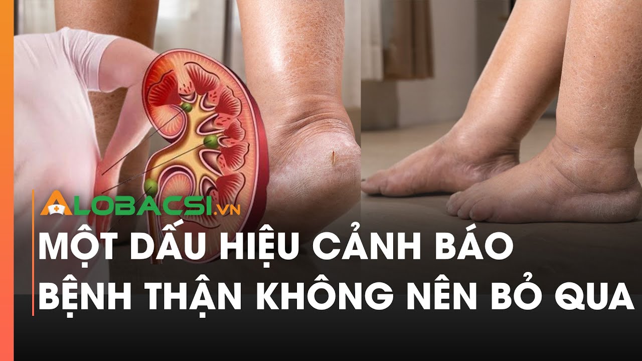 Một dấu hiệu cảnh báo bệnh thận không nên bỏ qua