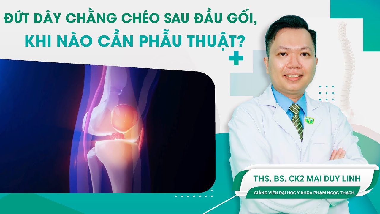 Đứt dây chằng chéo sau đầu gối, khi nào cần phẫu thuật? | BS.CK2 Mai Duy Linh