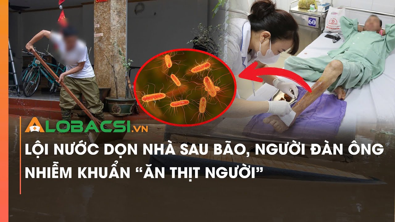 Lội nước dọn nhà sau bão, người đàn ông nhiễm khuẩn 'ăn thịt người' | Video Alobacsi