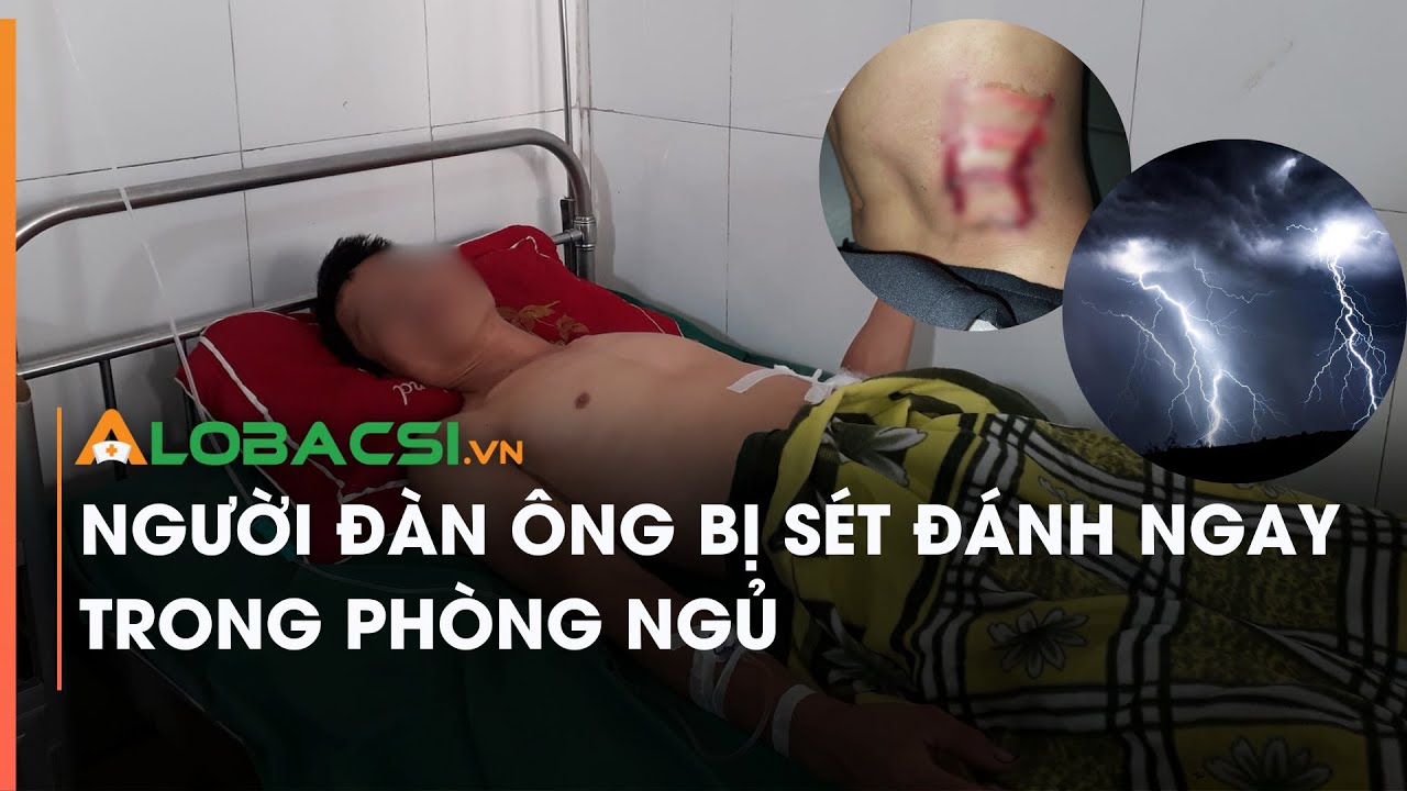 Người đàn ông bị sét đánh ngay trong phòng ngủ