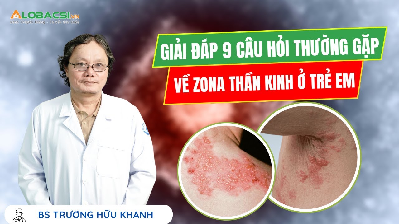 Giải đáp 9 câu hỏi thường gặp về Zona thần kinh ở trẻ em | BS Trương Hữu Khanh | Video Alobacsi