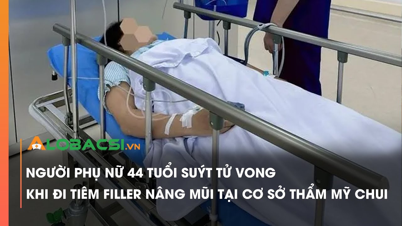 Người phụ nữ 44 tuổi suýt tử vong khi đi tiêm filler nâng mũi tại cơ sở thẩm mỹ chui