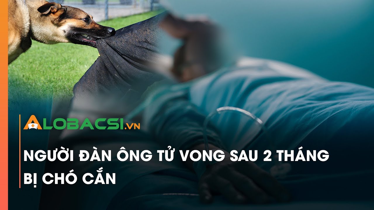 Người đàn ông tử vong sau 2 tháng bị chó cắn