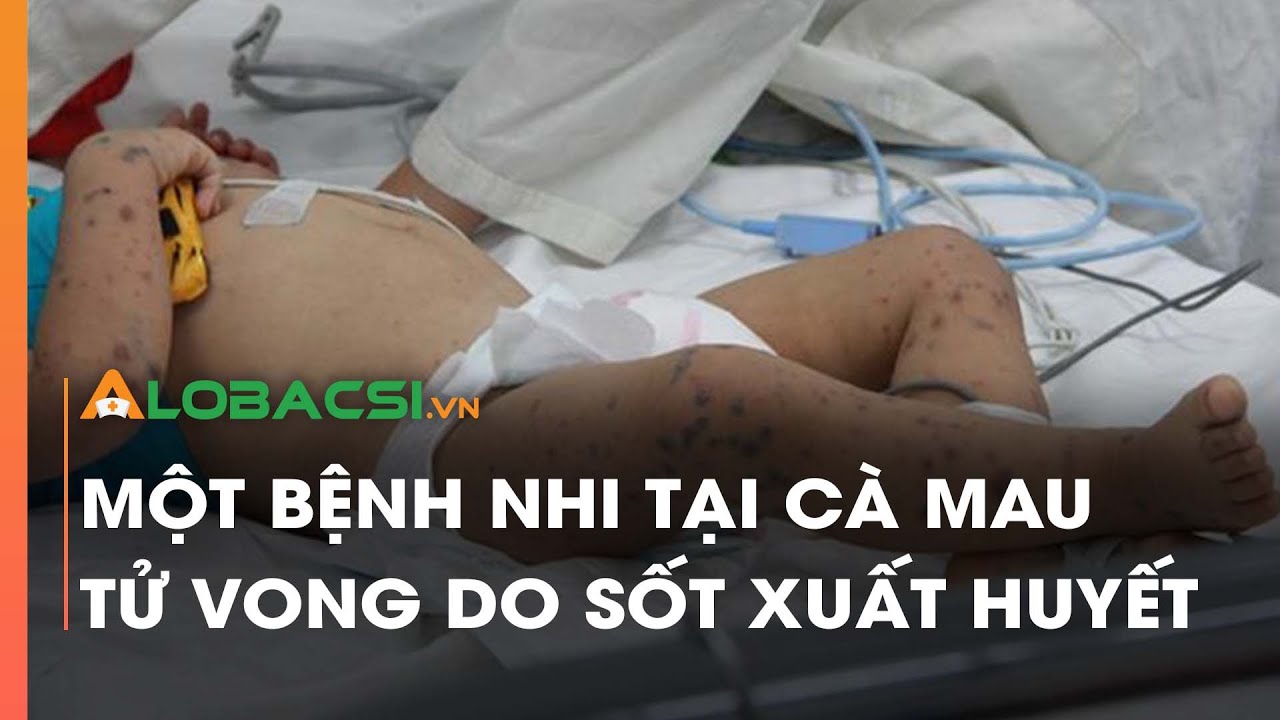 Một bệnh nhi tại Cà Mau tử vong do sốt xuất huyết