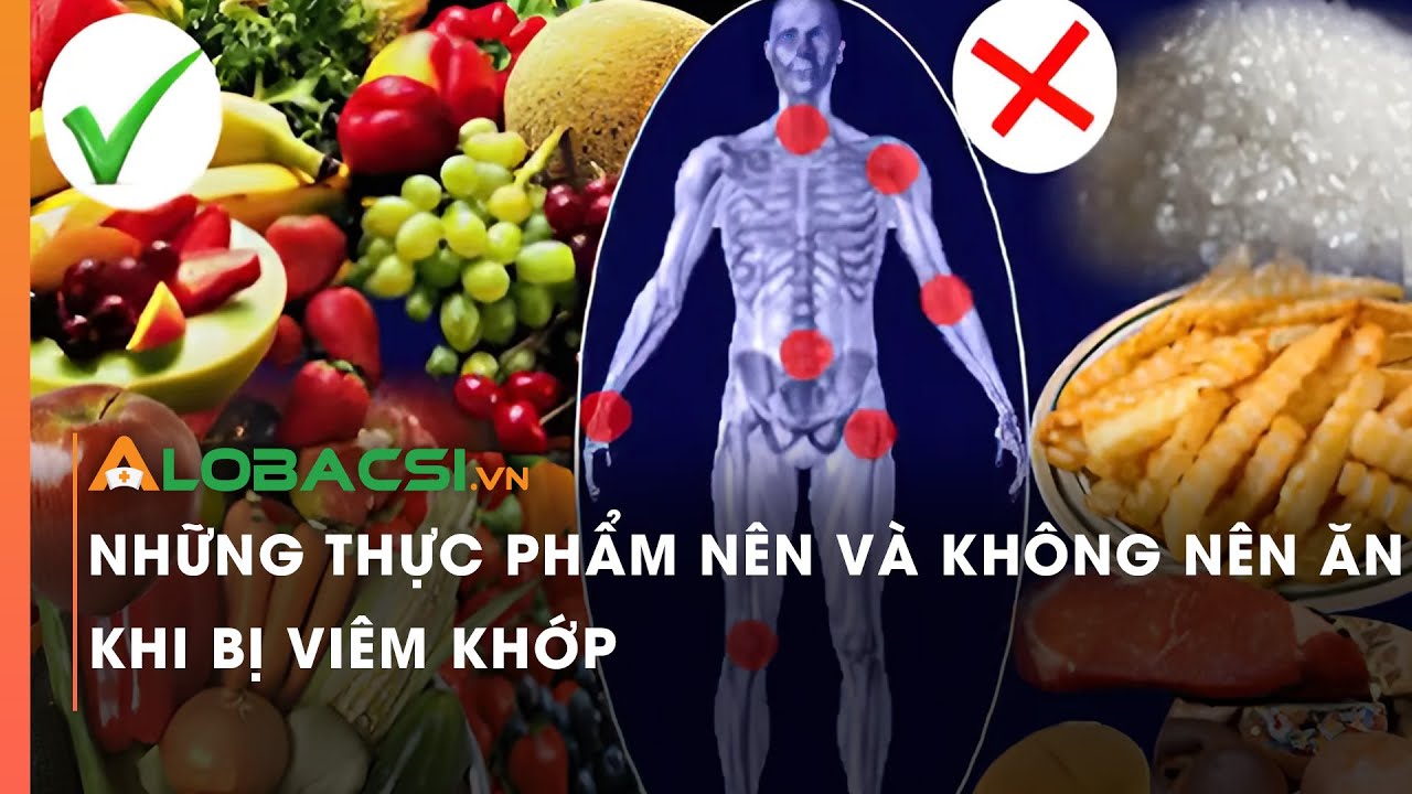 Những thực phẩm nên và không nên ăn khi bị viêm khớp