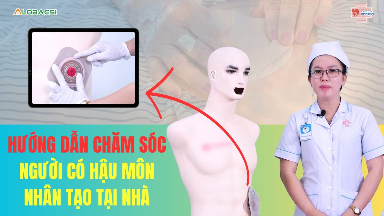 Hướng dẫn chăm sóc người có hậu môn nhân tạo tại nhà | BV Bình Dân