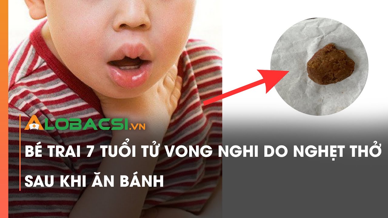 Bé trai 7 tuổi tử vong nghi do nghẹt thở sau khi ăn bánh