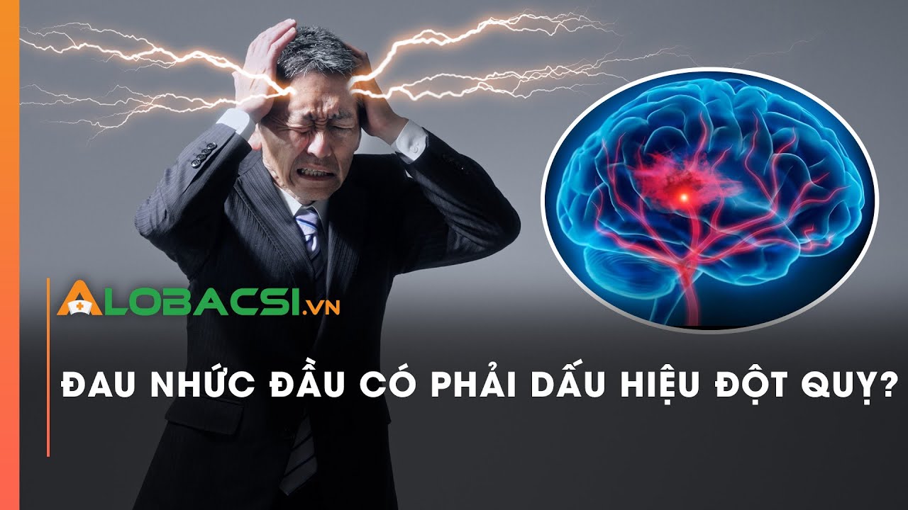 Đau nhức đầu có phải dấu hiệu đột quỵ?