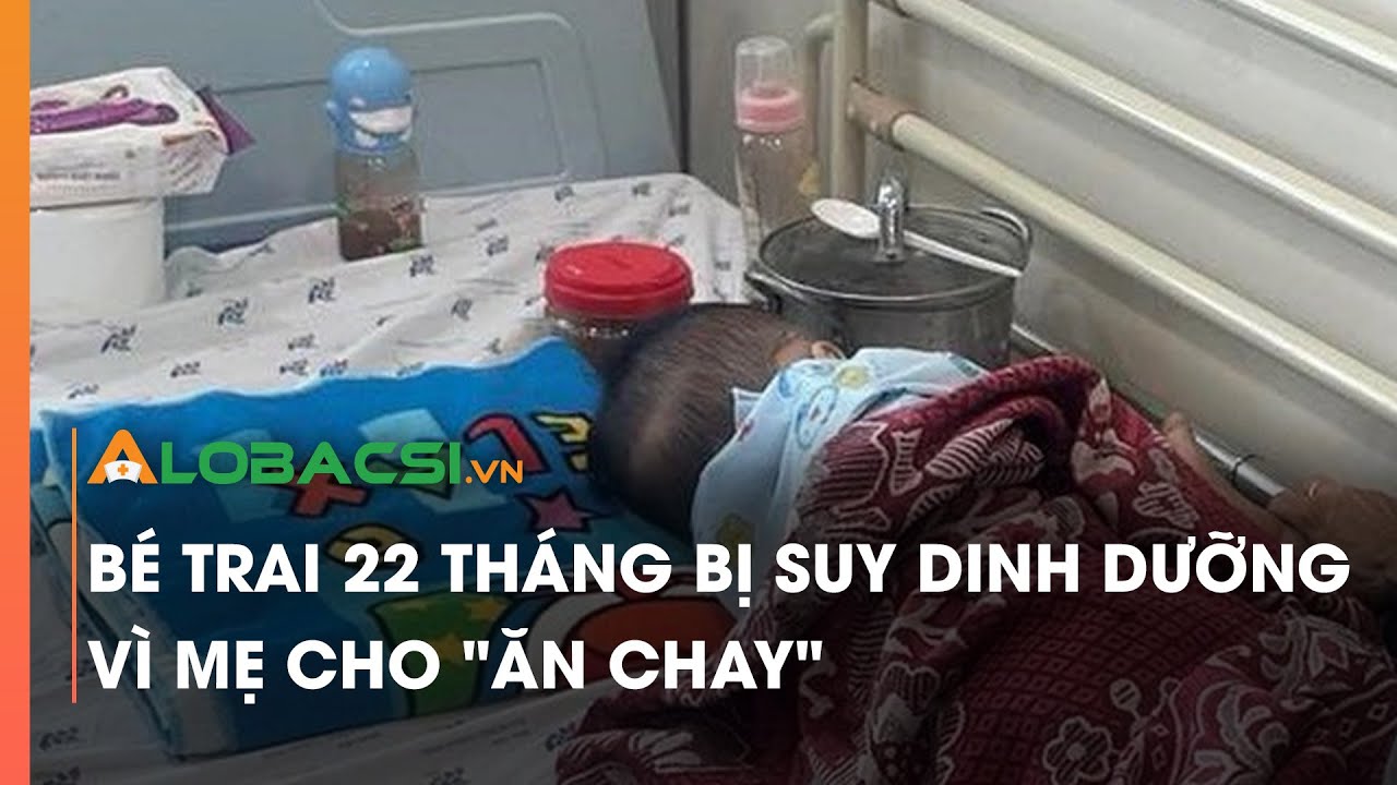 Bé trai 22 tháng bị suy dinh dưỡng vì mẹ cho "ăn chay"