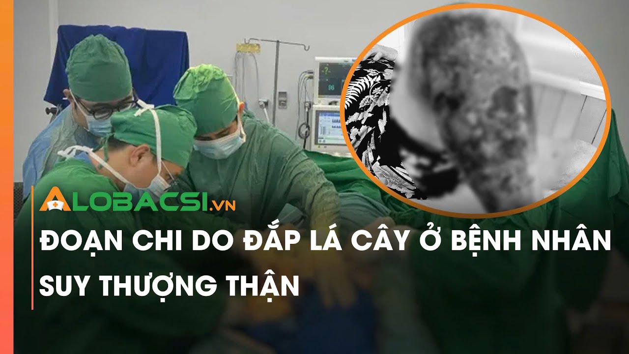 Đoạn chi do đắp lá cây ở bệnh nhân suy thượng thận | Video Alobacsi