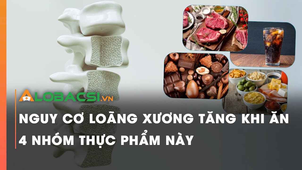 Nguy cơ loãng xương tăng khi ăn 4 nhóm thực phẩm này | Video Alobacsi