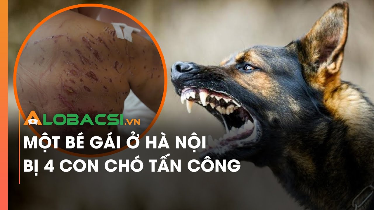 Một bé gái ở Hà Nội bị 4 con chó tấn công