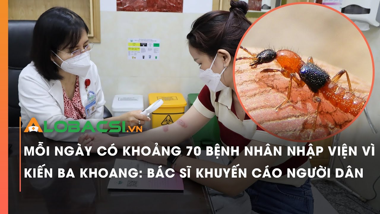 Kiến ba khoang tấn công, khoảng 70 người nhập viện/ngày: Bác sĩ khuyến cáo người dân