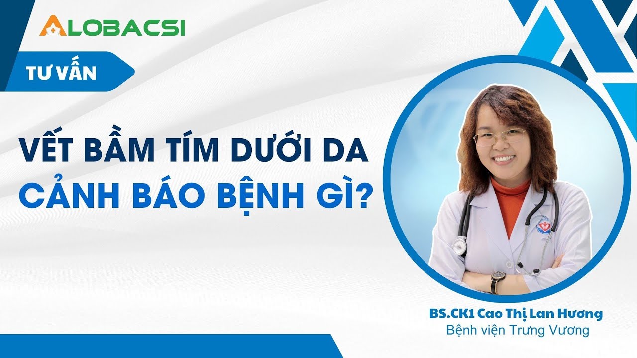 Vết bầm tím dưới da, cảnh báo bệnh gì?