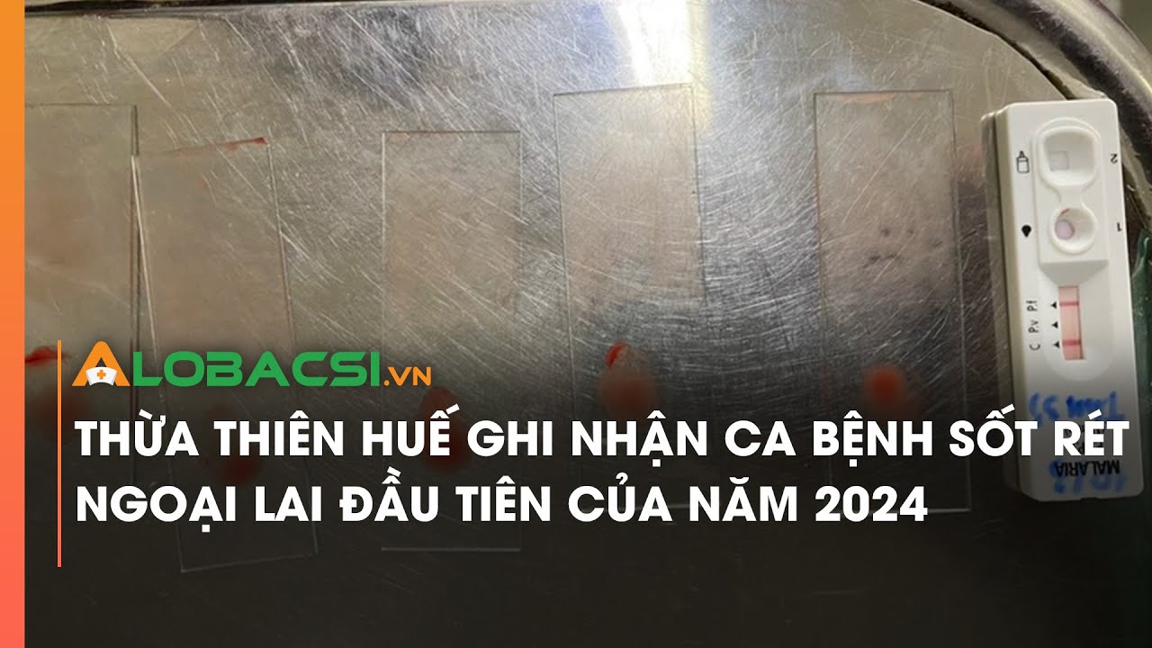 Thừa Thiên Huế ghi nhận ca bệnh sốt rét ngoại lai đầu tiên của năm 2024