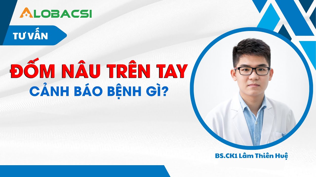 Xuất hiện đốm nâu trên tay là bị gì?