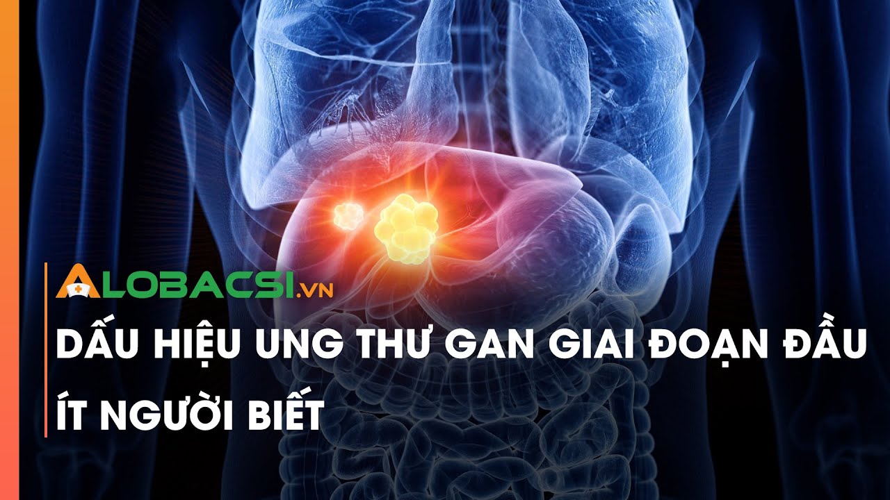 Dấu hiệu ung thư gan giai đoạn đầu ít người biết