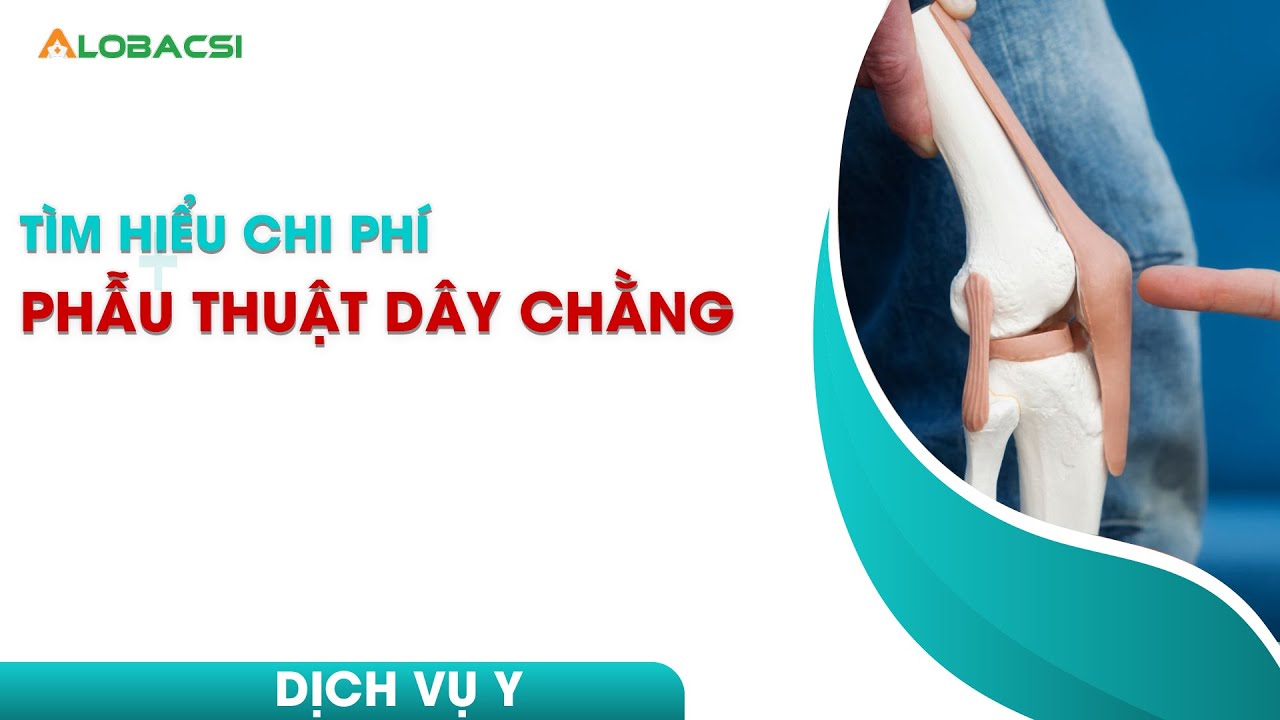 Tìm hiểu chi phí phẫu thuật dây chằng