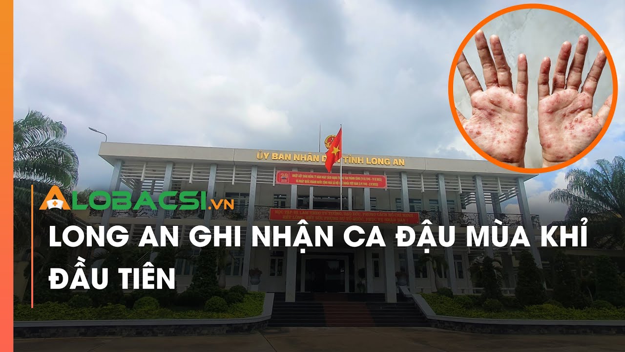 Long An ghi nhận ca đậu mùa khỉ đầu tiên