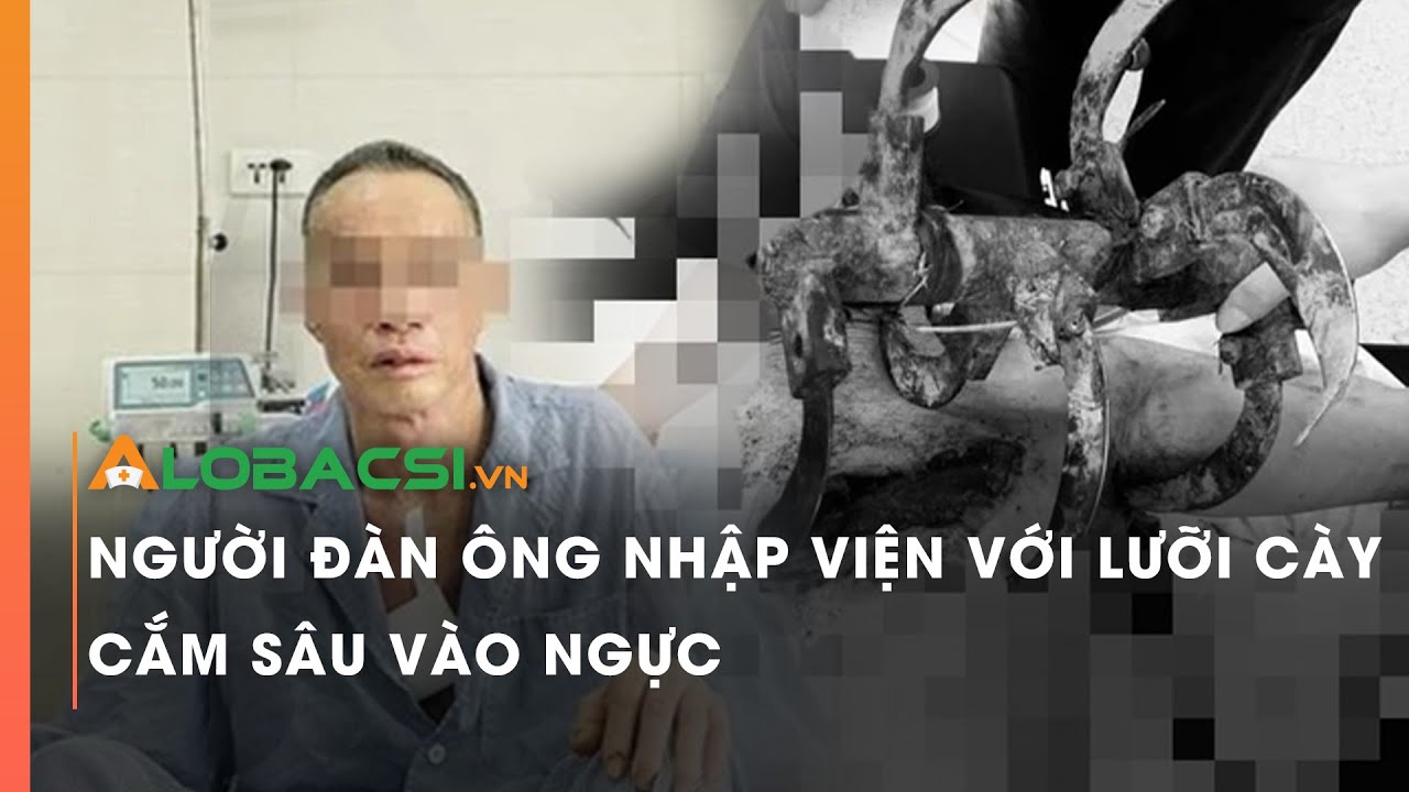 Người đàn ông nhập viện với lưỡi cày cắm sâu vào ngực