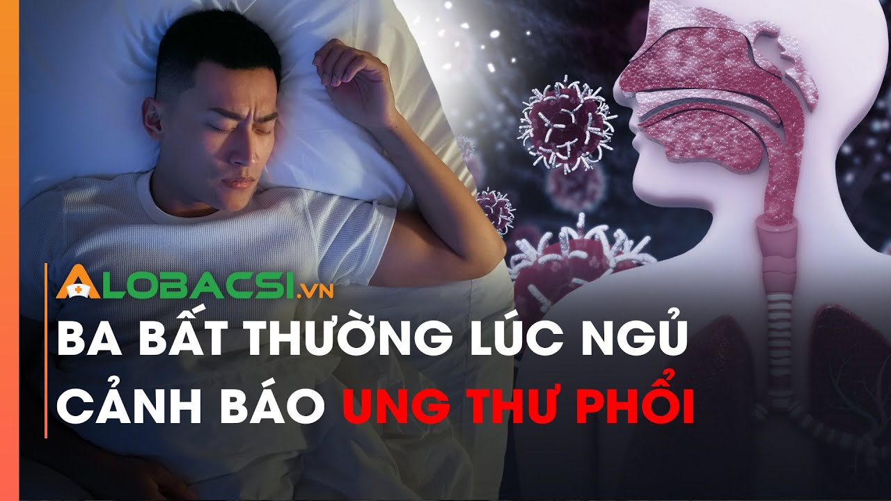 Ba bất thường lúc ngủ cảnh báo ung thư phổi