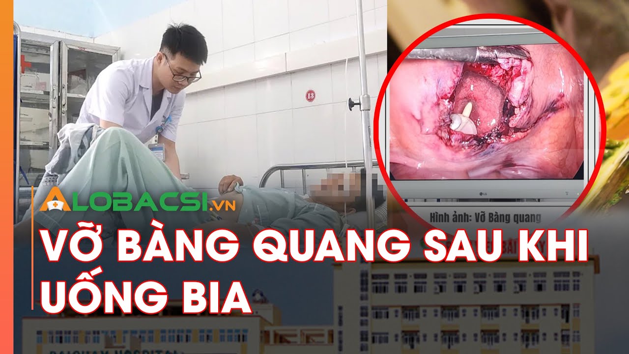 Người đàn ông vỡ bàng quang sau khi uống bia