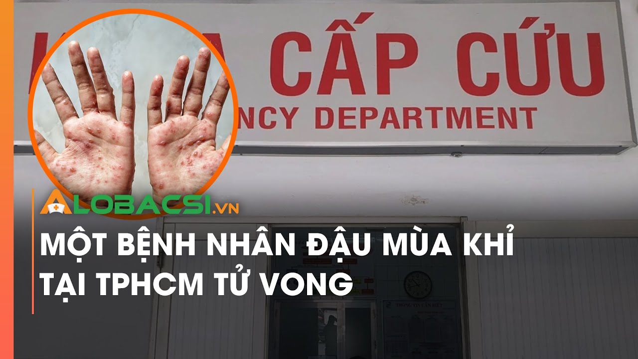 Một bệnh nhân đậu mùa khỉ tại TPHCM tử vong