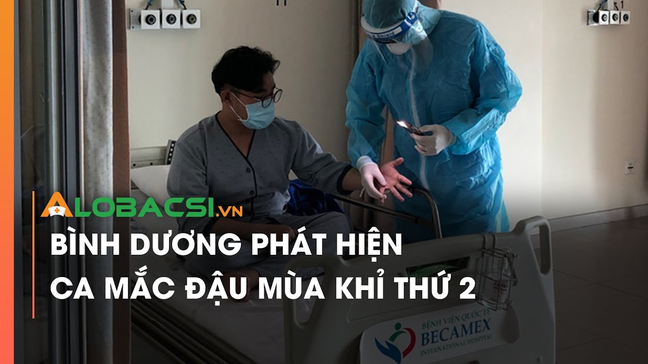 Bình Dương phát hiện ca mắc đậu mùa khỉ thứ 2