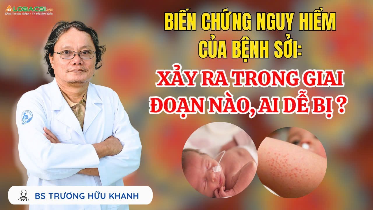 Biến chứng nguy hiểm của bệnh sởi, xảy ra trong giai đoạn nào, ai dễ bị? | BS Trương Hữu Khanh