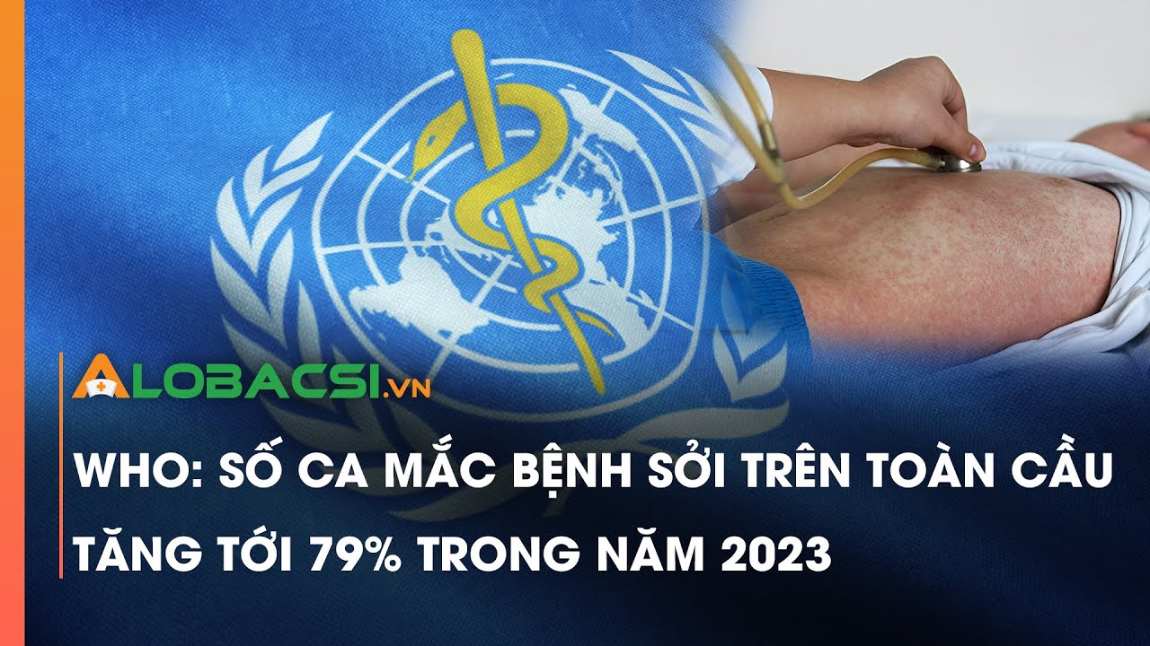 WHO: Số ca mắc bệnh sởi trên toàn cầu tăng tới 79% trong năm 2023