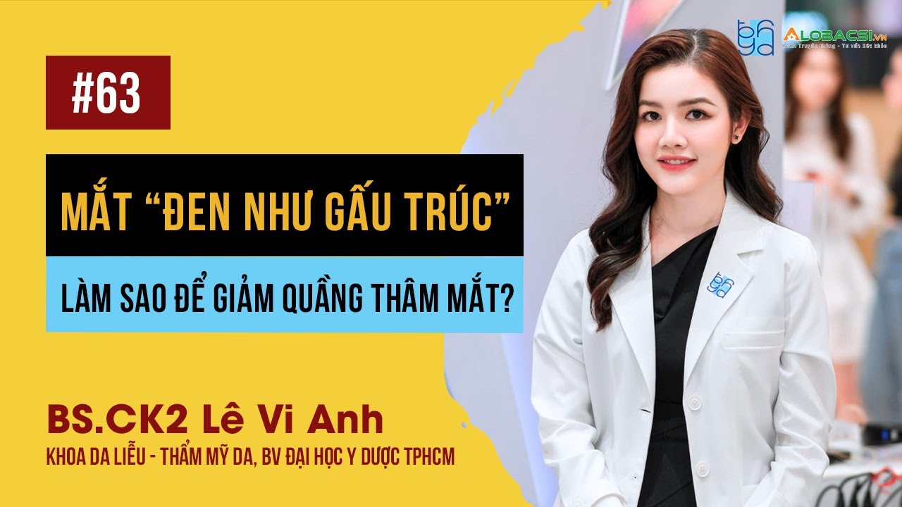 Mắt “đen như gấu trúc”, làm sao để giảm quầng thâm mắt?