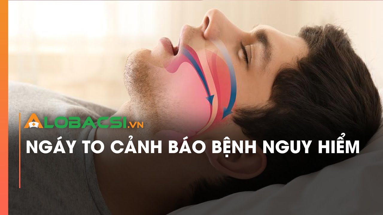 Ngáy to cảnh báo bệnh nguy hiểm