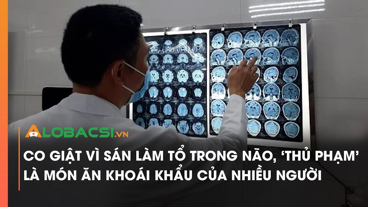 Não người đàn ông tổn thương sau nhiều năm có thói quen ăn tiết canh, thịt tái | Video Alobacsi