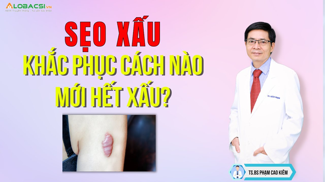 Sẹo xấu, khắc phục cách nào mới hết xấu? TS.BS Phạm Cao Kiêm