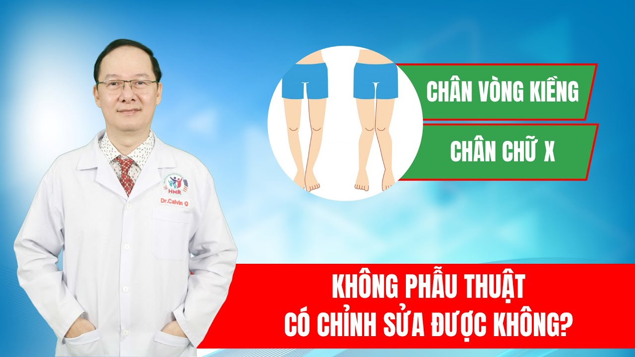 Chân vòng kiềng và chân chữ X không phẫu thuật có chỉnh sửa được không? | ThS.BS Calvin Q Trịnh