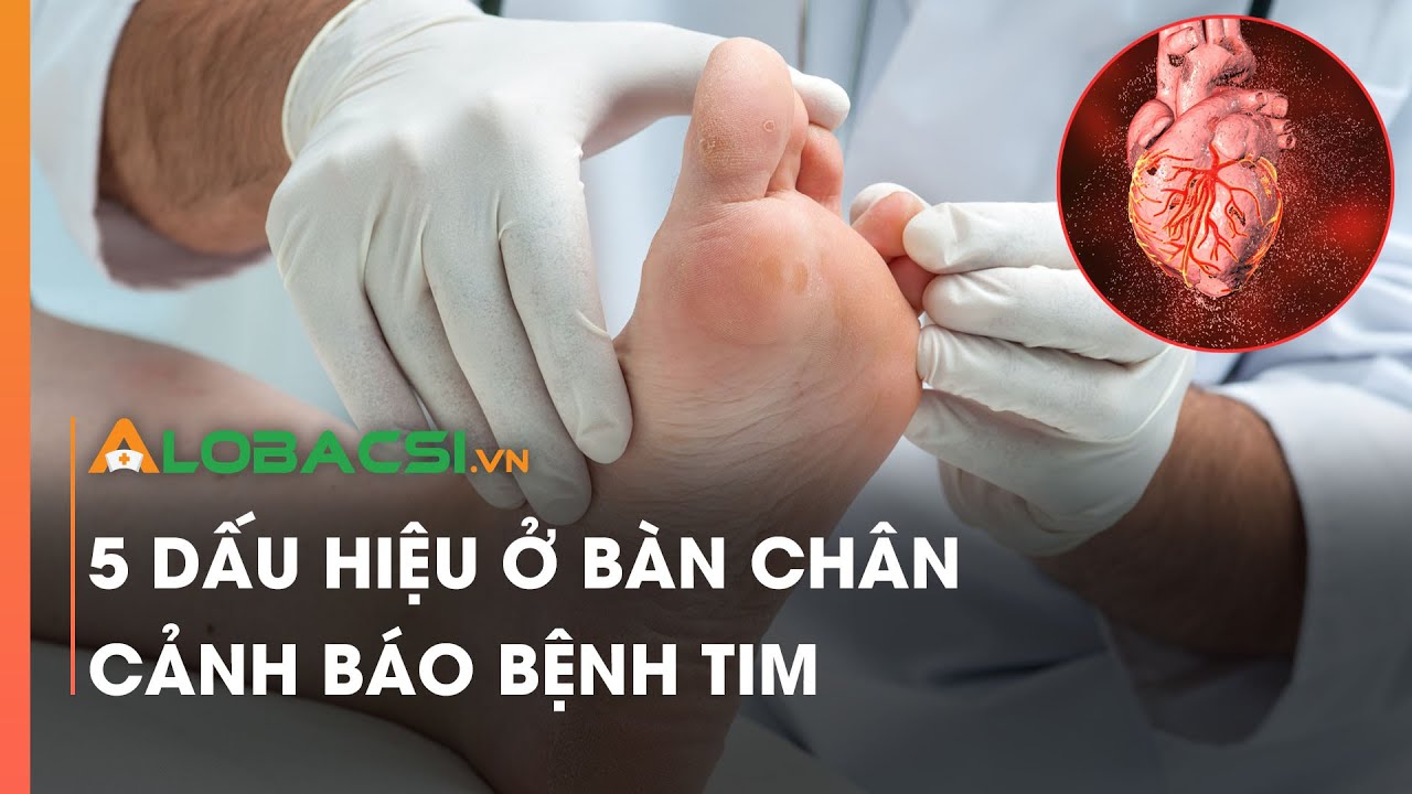 5 dấu hiệu ở bàn chân cảnh báo bệnh tim