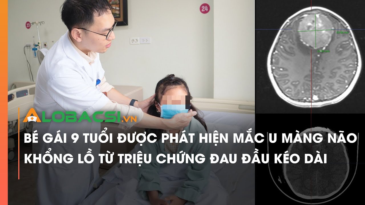 Bé gái 9 tuổi được phát hiện mắc u màng não khổng lồ từ triệu chứng đau đầu kéo dài