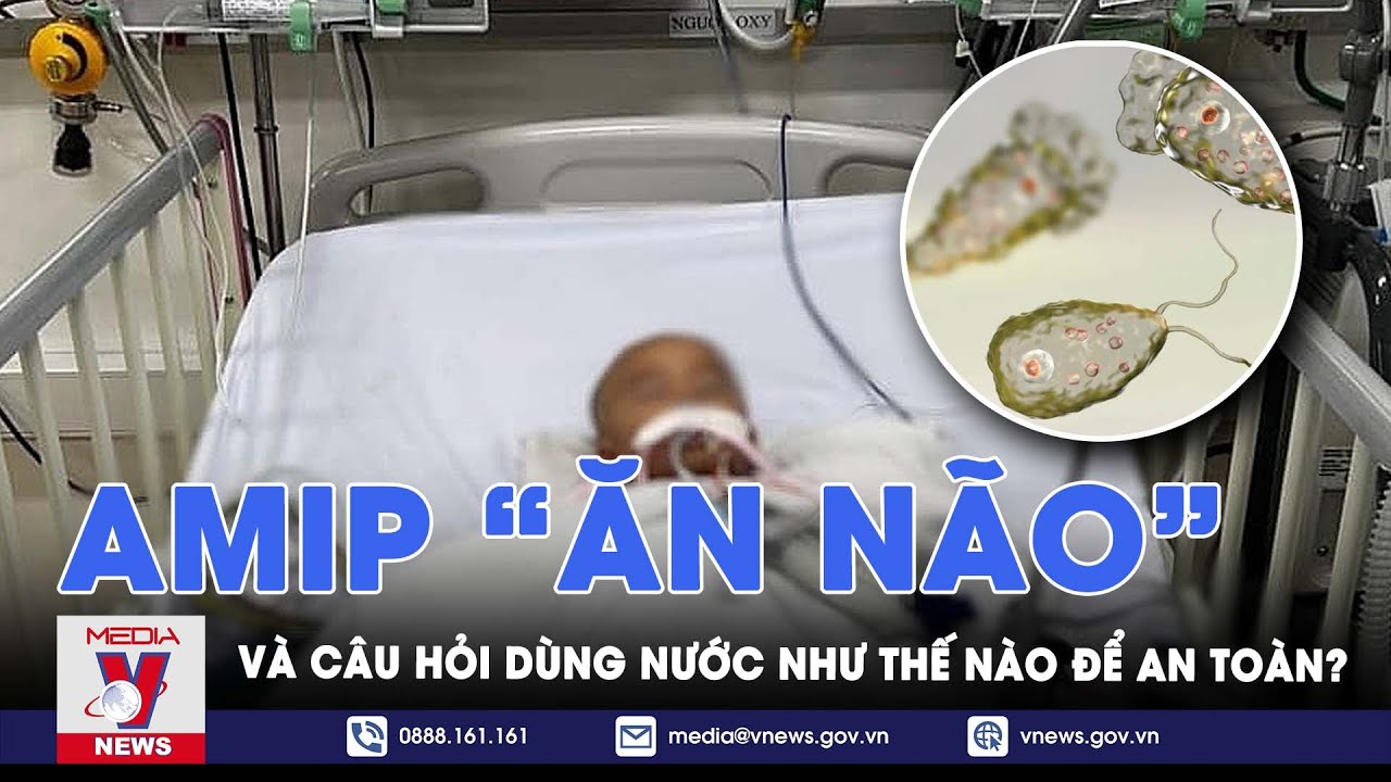 Nỗi lo sau vụ cháu bé 10 tháng tuổi bị ký sinh trùng “ăn não” và loạt câu hỏi bỏ ngỏ về nguồn nước