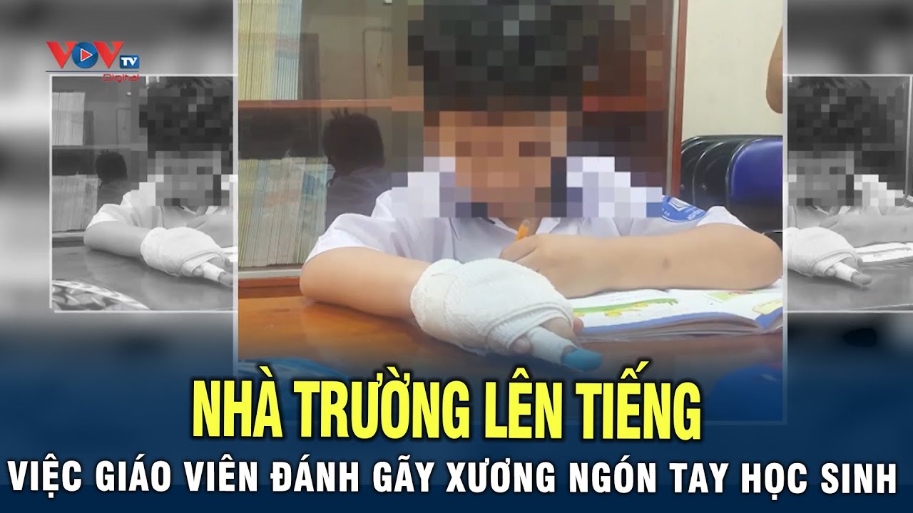 Trường Tiểu Học Nguyễn Văn Trỗi Lên Tiếng Việc Giáo Viên Đánh Gãy Xương Ngón Tay Học Sinh