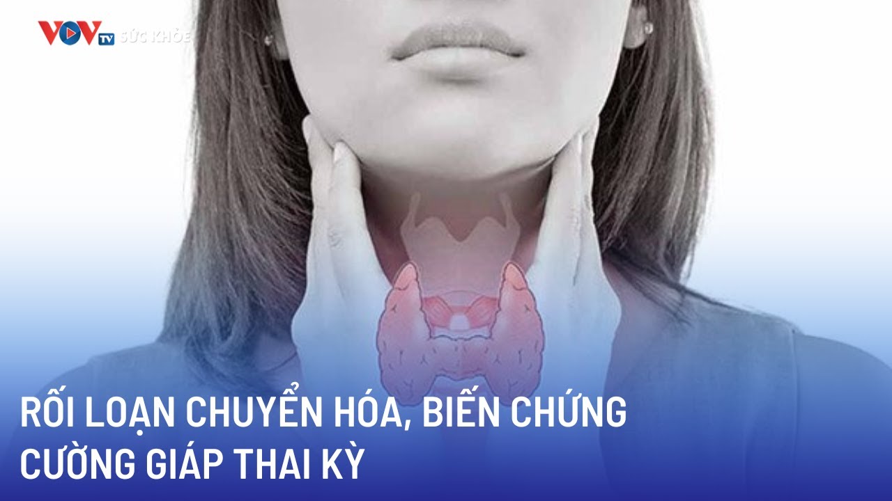 Rối loạn chuyển hóa, biến chứng cường giáp thai kỳ | Bản tin Sức khỏe 24h