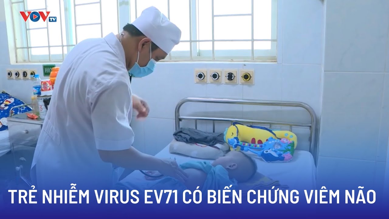 Nhiều trẻ nhiễm Virus EV71, có biến chứng viêm não | Bản tin Sức khỏe 24h