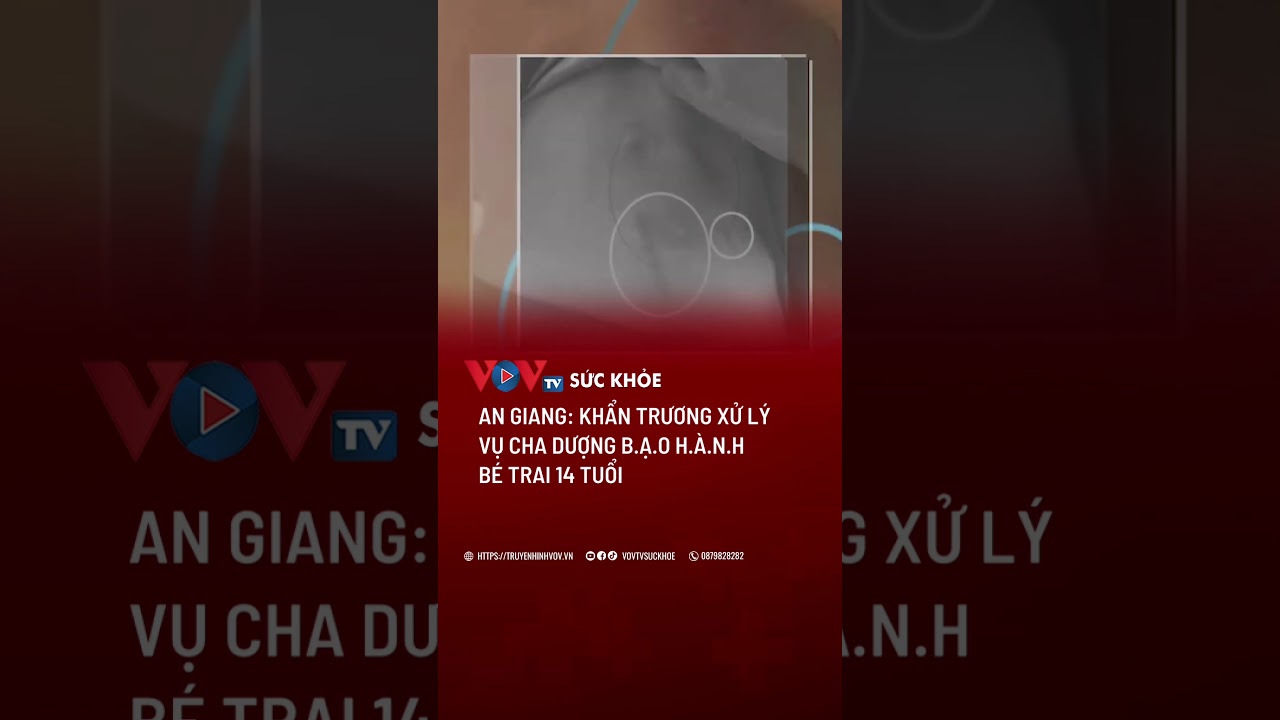 An Giang: Khẩn trương xử lý vụ cha dượng b.ạ.o h.à.n.h bé trai 14 tuổi | VOVTV Sức khỏe